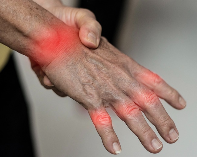 HAND SMALL JOINT ARTHROPLASTY