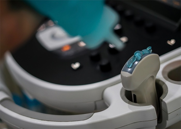 ULTRASOUND-GUIDED ASPIRATIONS