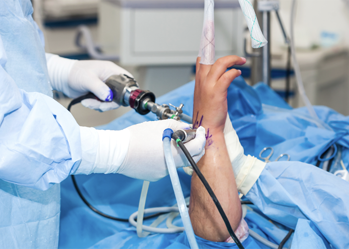 WRIST & ELBOW ARTHROSCOPY