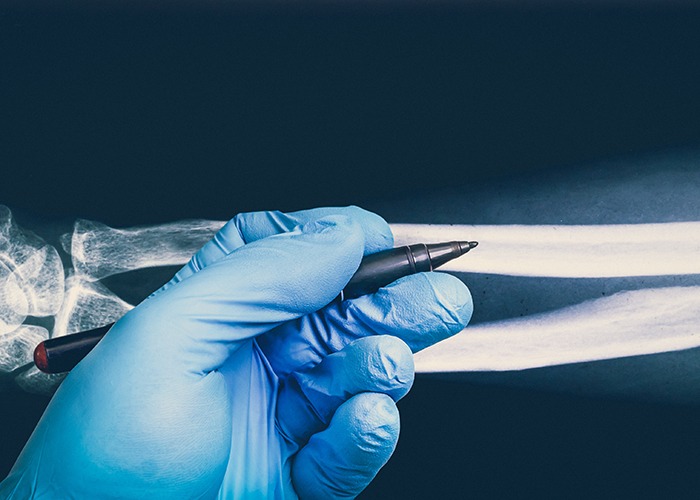 FOREARM AND ELBOW FRACTURE SURGERY
