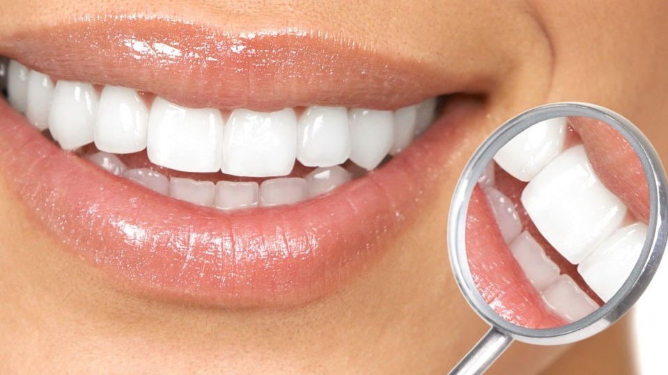 Affordable-Dentist-Oakdale-Modesto