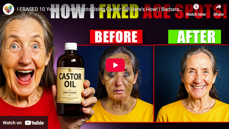 Erase age spots naturally with castor oil; before and after results.