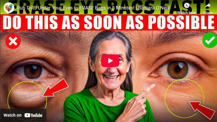 Erase Under Eye Bags Fast with effective treatment shown in comparison.