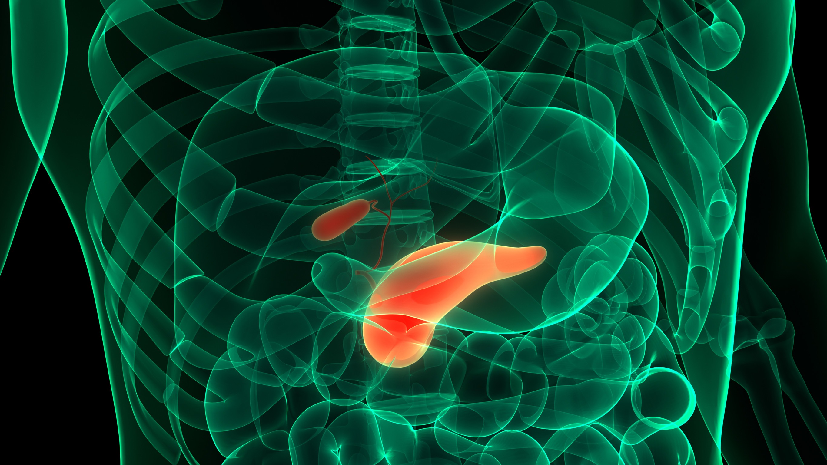 Pancreatic model highlighting Tumor Treating Fields research.