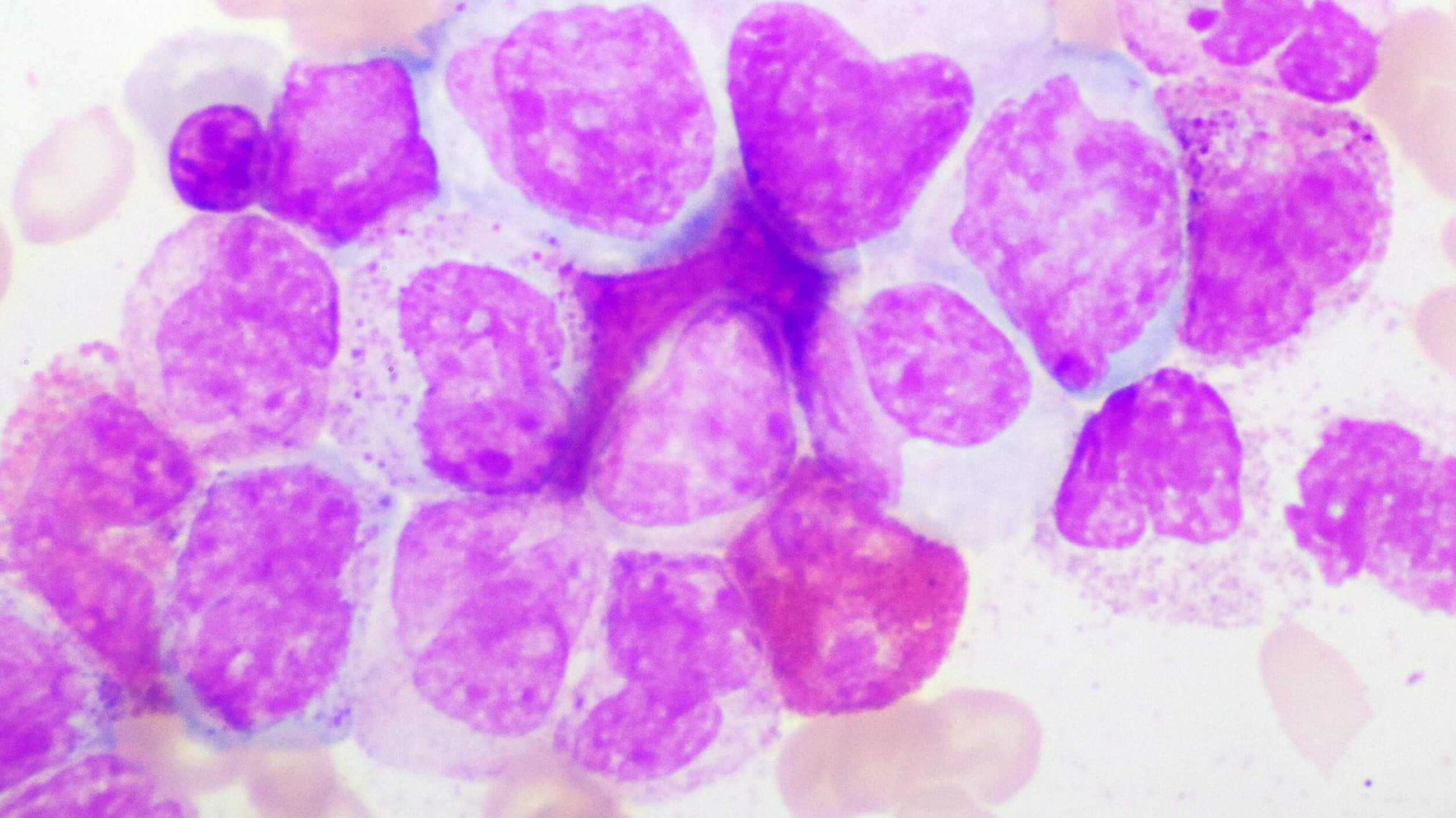 Colorful depiction of blood cells for Asciminib in chronic myeloid leukemia.