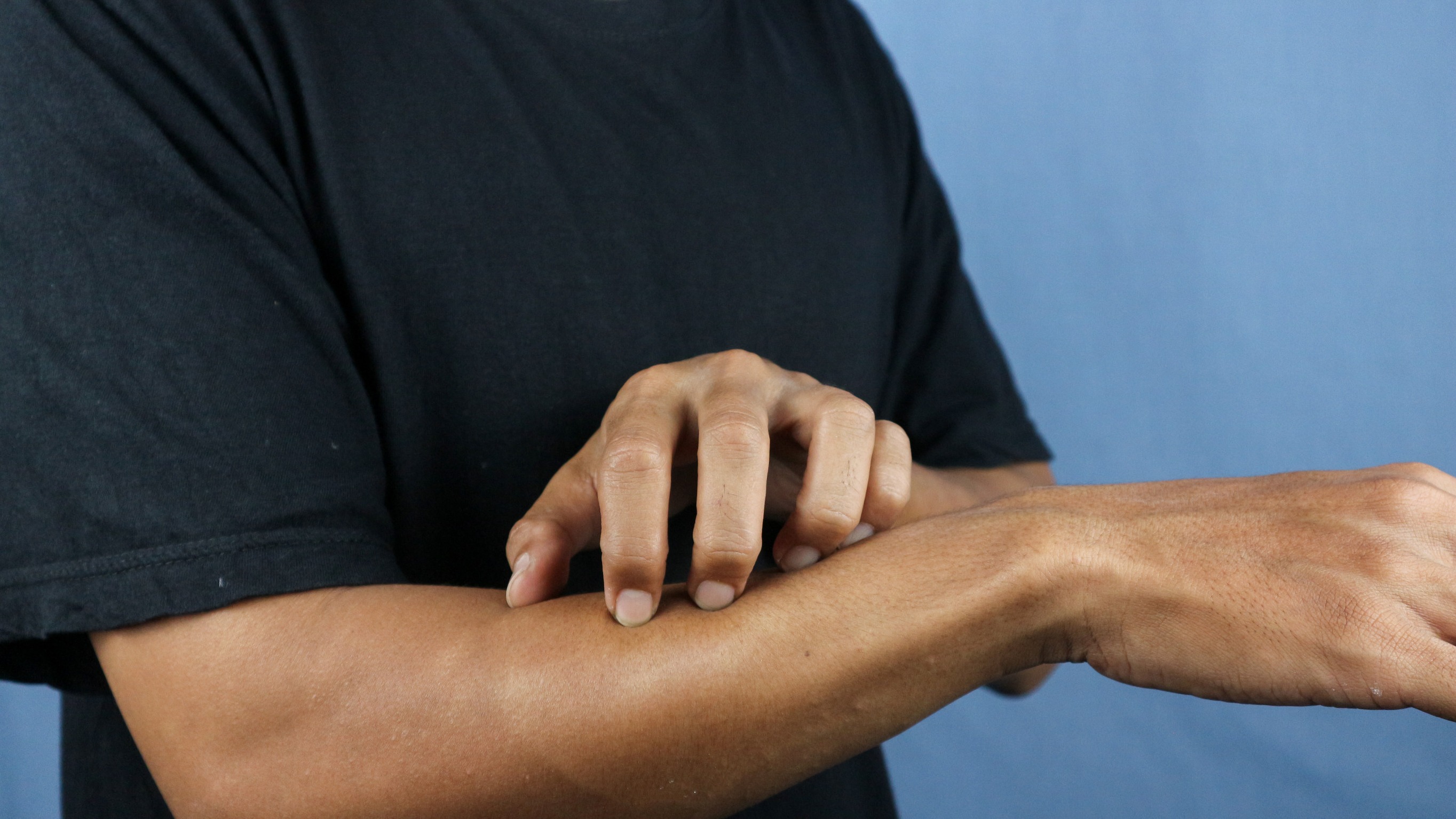 Skin causing itching
