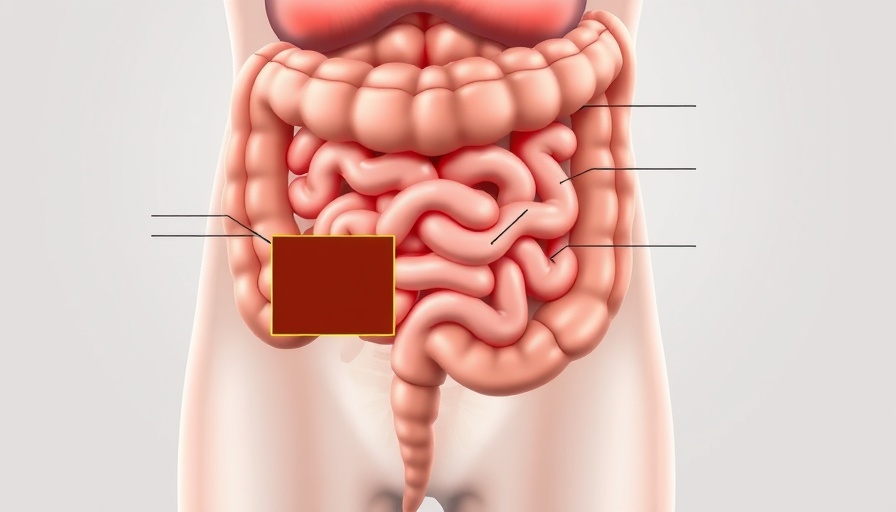 Illustration of large bowel obstruction with detailed anatomy.