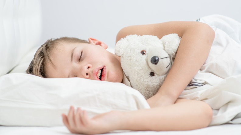 Sleep Apnea