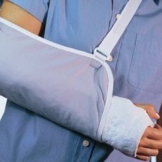 arm with cast