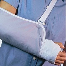Arm in a cast
