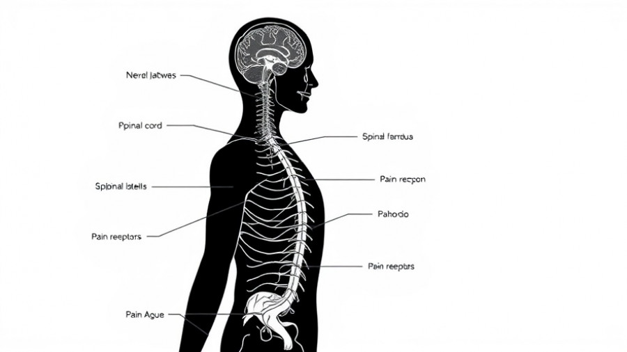 Centrally Mediated Abdominal Pain Syndrome diagram showing pain pathways.