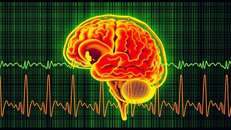 Subscalp EEG System: Transforming Long-Term Seizure Monitoring in Epilepsy Care