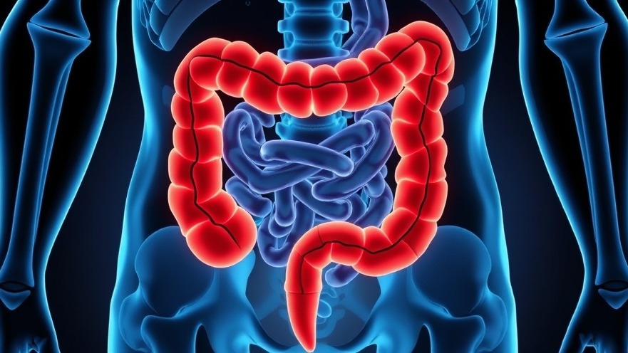 The Burden of Early-Onset Colorectal Cancer: An Unequal Fight Across Communities