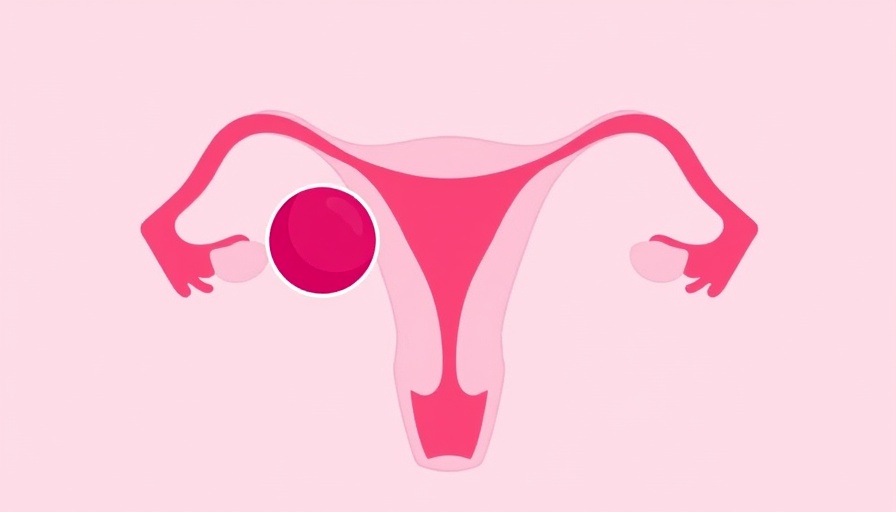 Abstract illustration of female reproductive system highlighting ovarian cyst