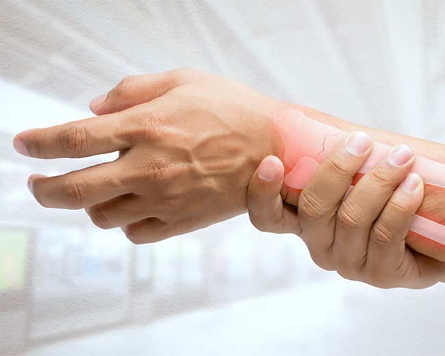 HAND AND WRIST FRACTURES