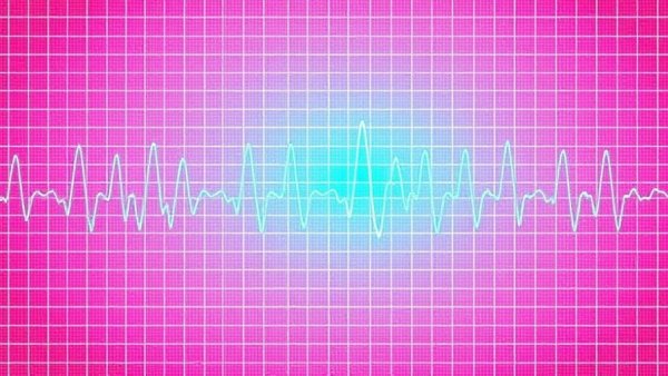 ECG showing detailed heart rhythm waves, monitoring Diltiazem with blood thinners