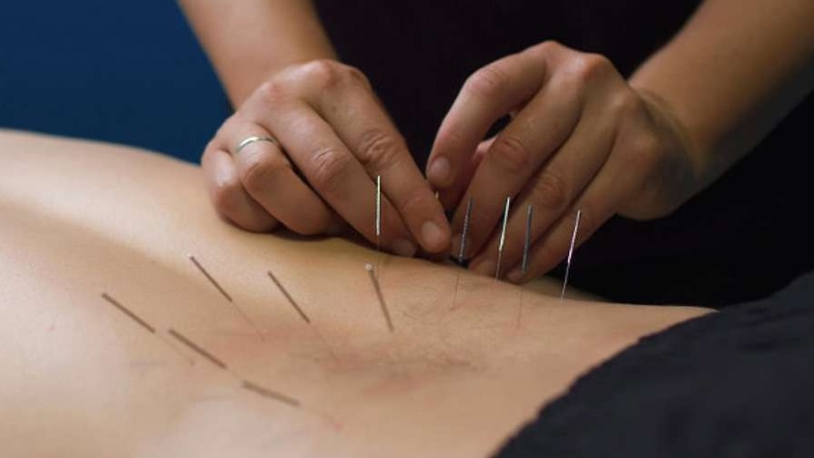 Physical therapist applying dry needling treatment to patient’s shoulder in modern clinic