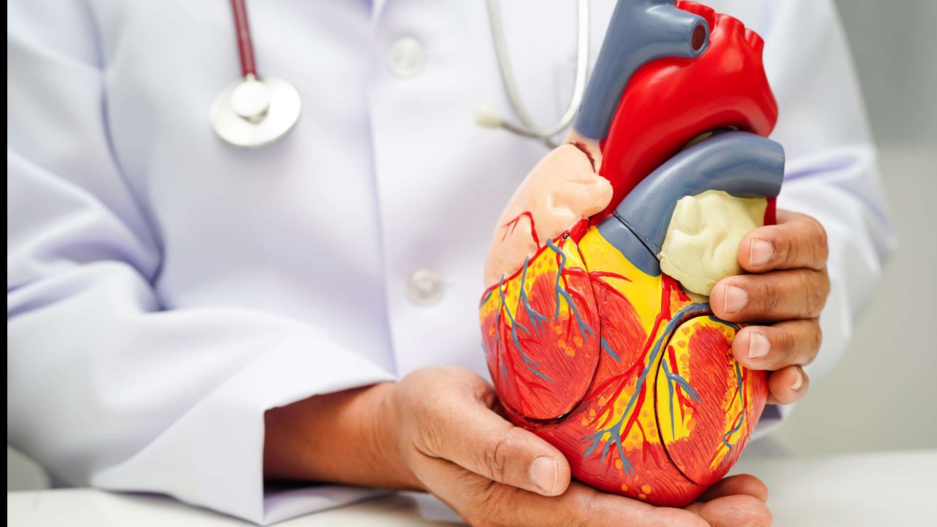 Anatomical model of human heart, Minimally Invasive CABG.