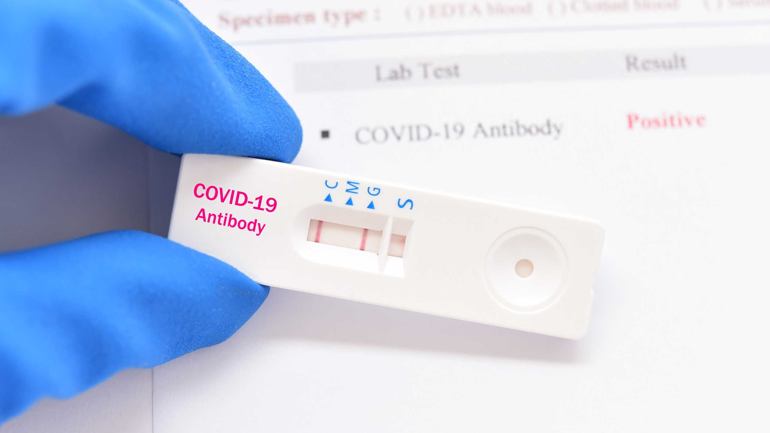 COVID-19 Test 