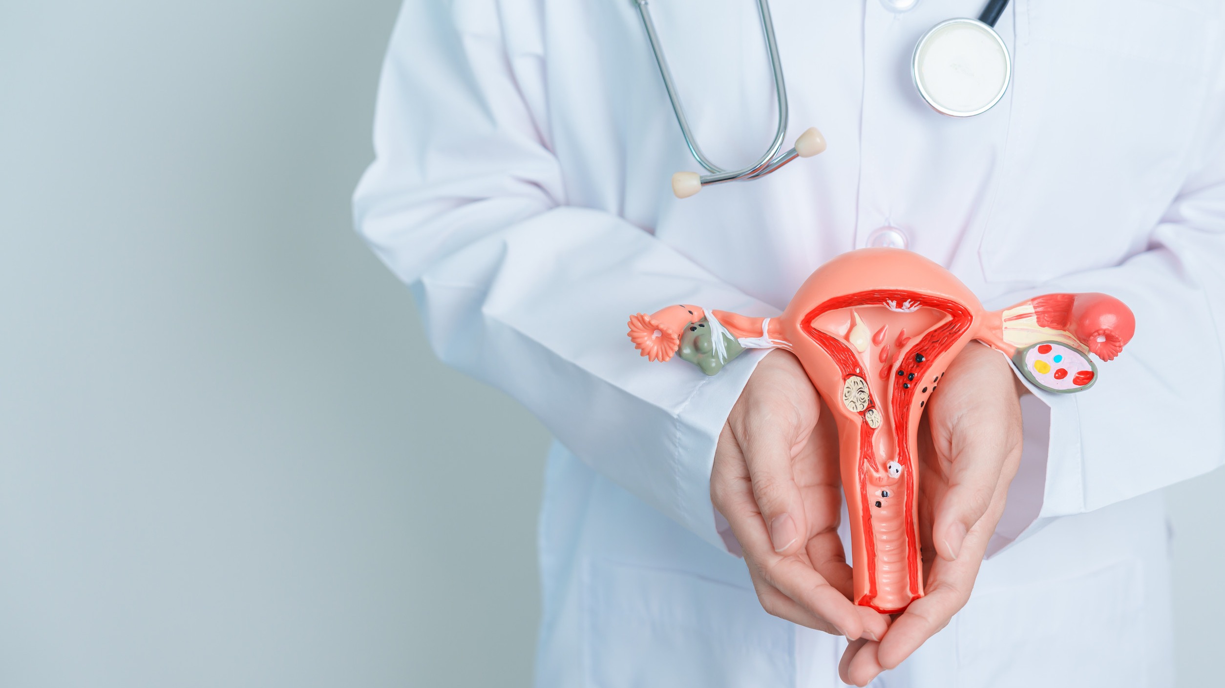 Anatomical illustration highlighting a tumor in the reproductive system for Blood-Based KRAS Testing.