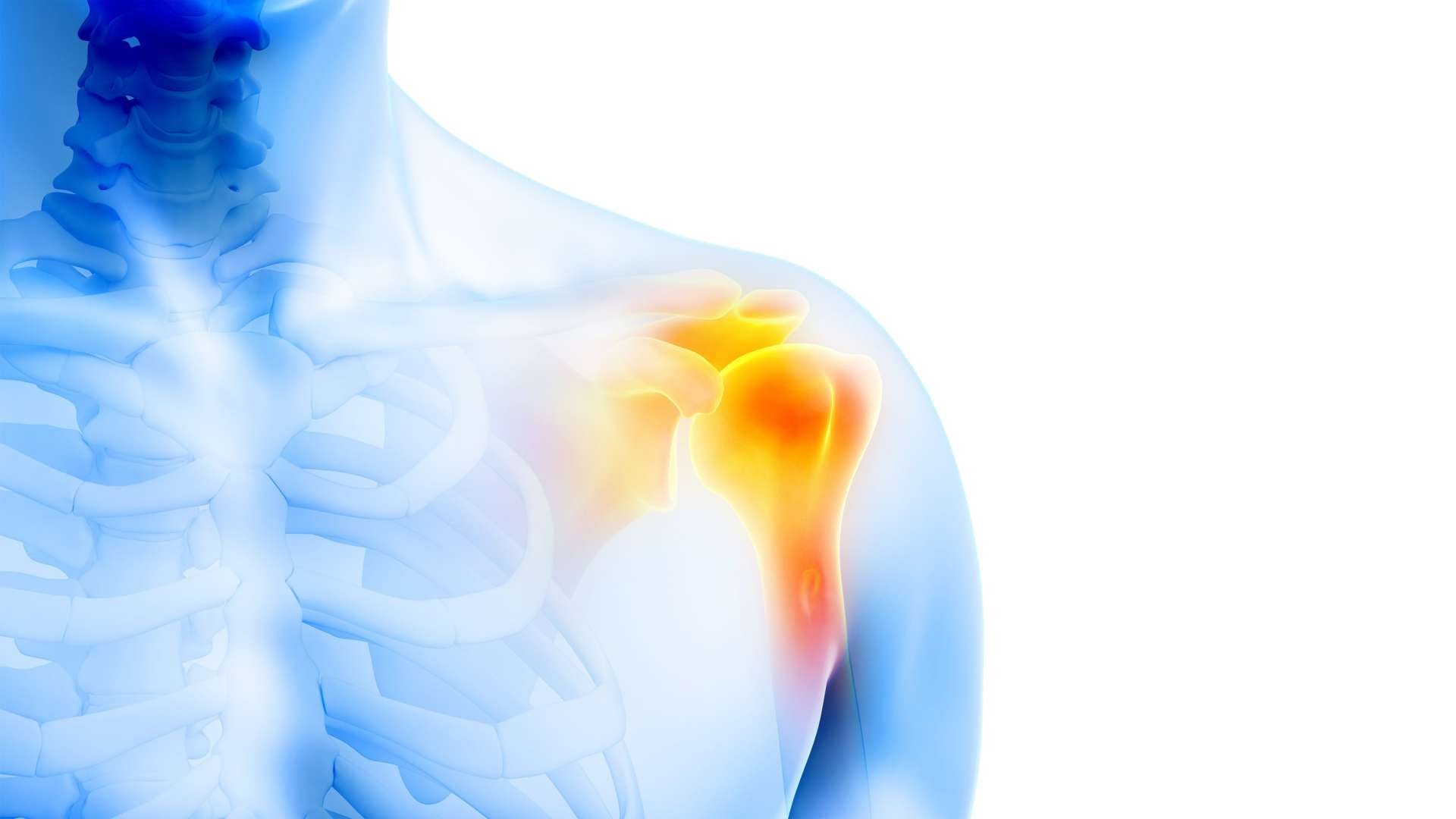 My shoulder — The Inciteful Med, Claude & HealthX update