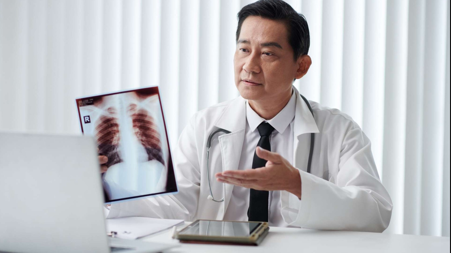 Dr reveiwing xray for HIV TB symptoms understanding.