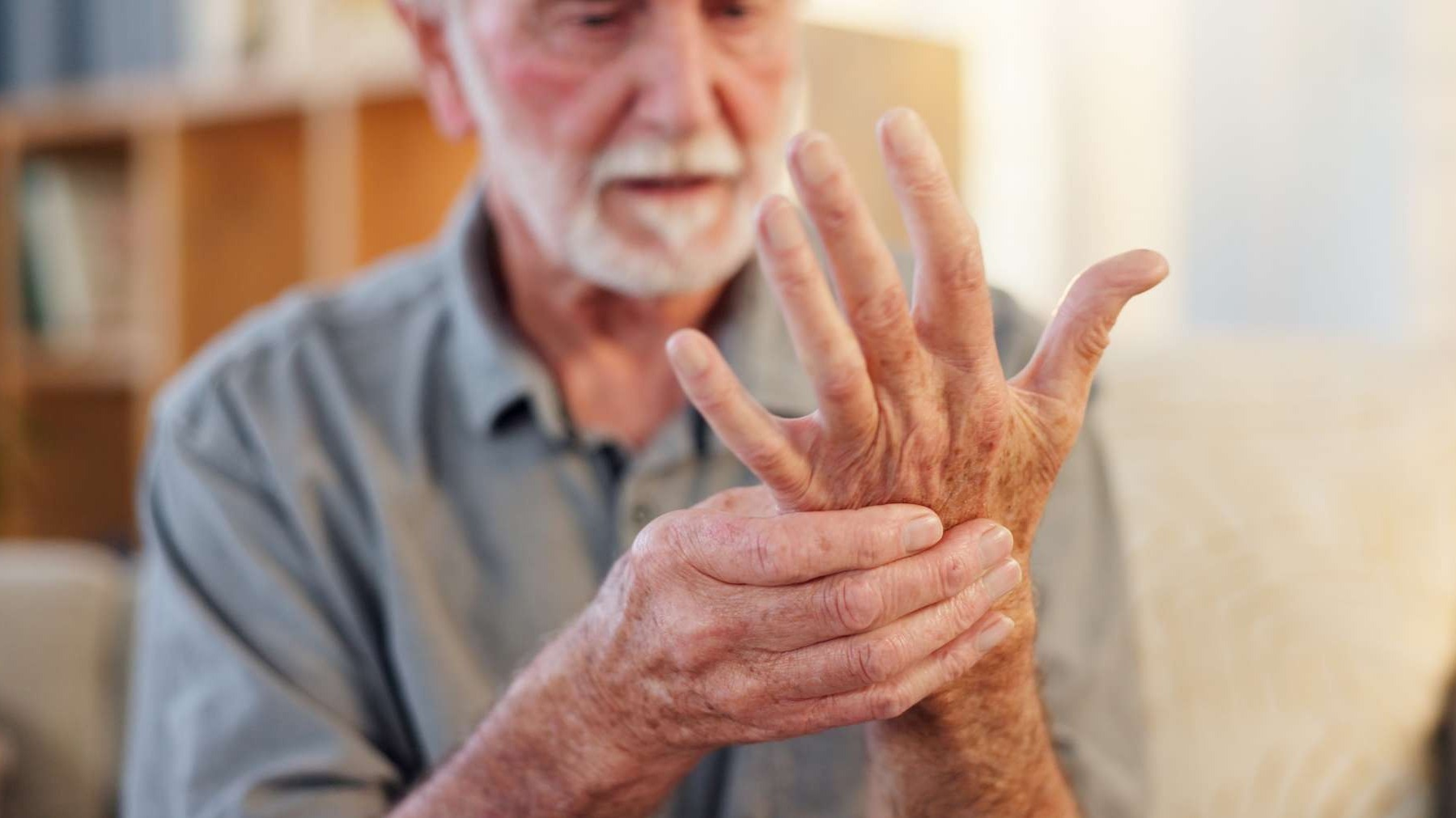 Aged hands, potential psoriatic arthritis signs.