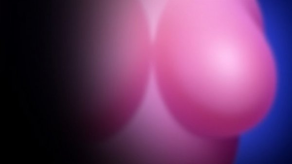 Dr. Wolfe’s 25-Year Perspective on Breast Implant Evolution and Motiva®