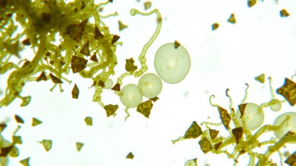 Microscopic Paramecium Bursaria with algae showcasing Earth's oxygen sources.