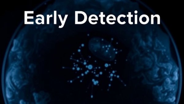 AI helps radiologists detect breast cancer with early detection focus.