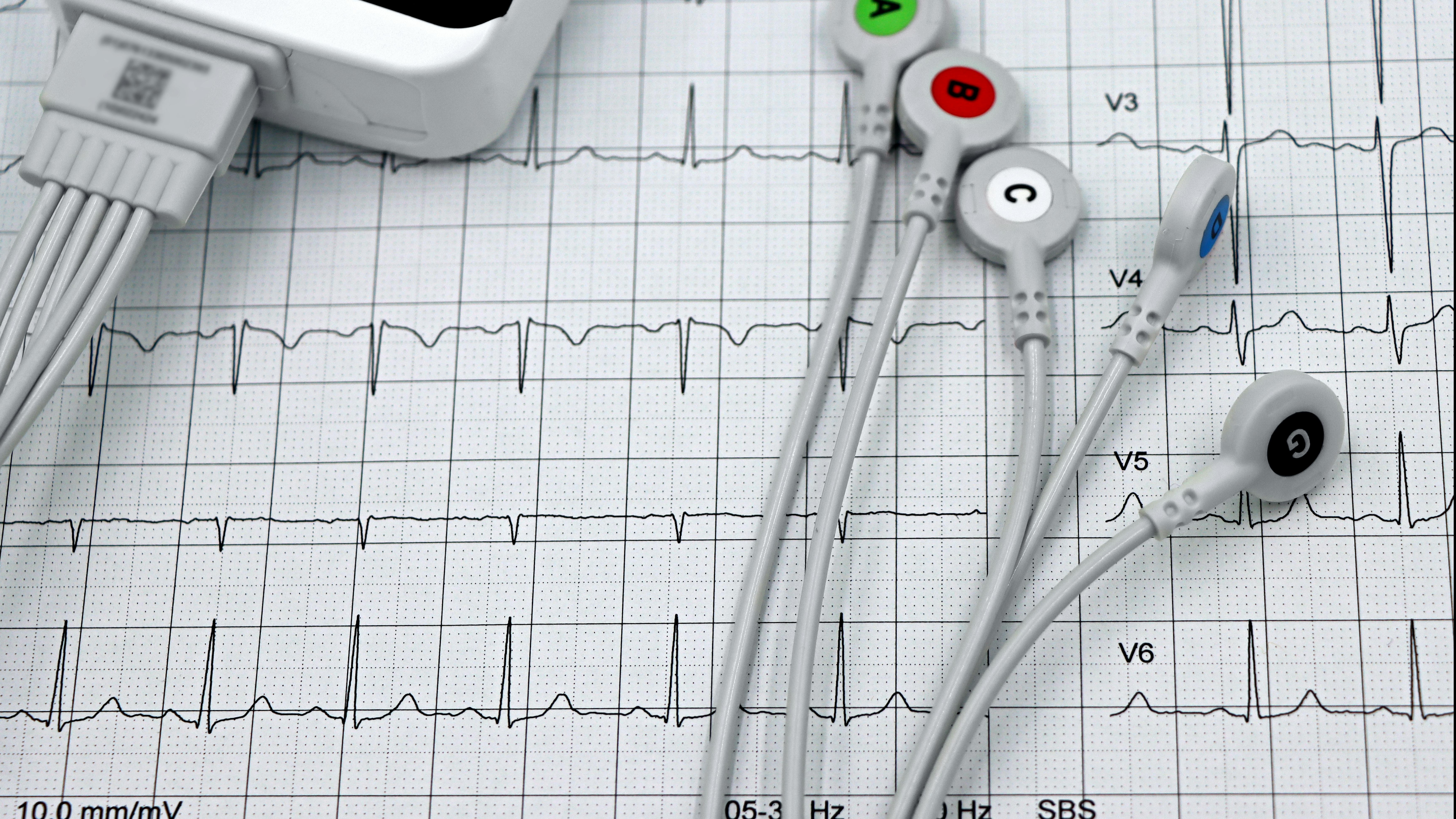 Chart illustrating fetal heart tones monitoring patterns and explanations.
