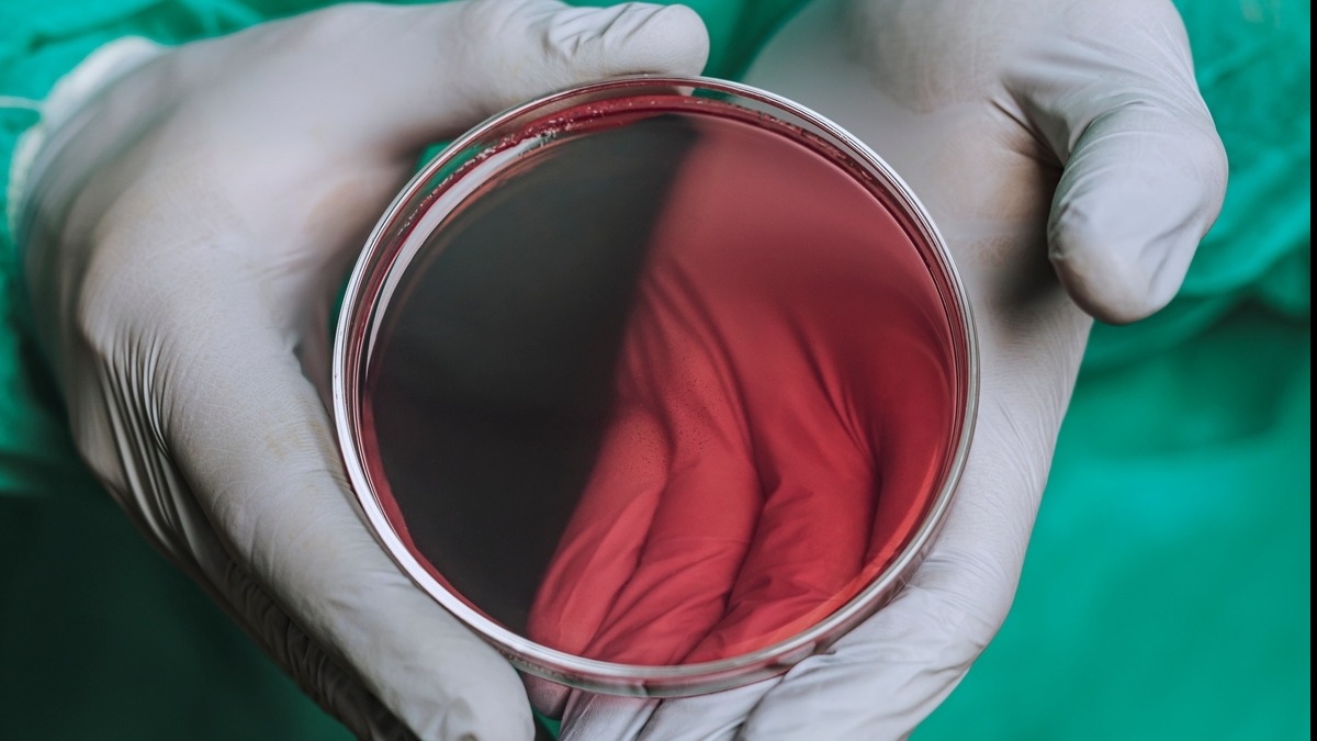 Promotional graphic on Antimicrobial Resistance Action Plans, emphasizing urgency.