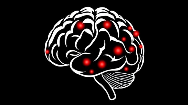 Abstract brain illustration representing APOE E4 Alzheimer’s Disease risk.
