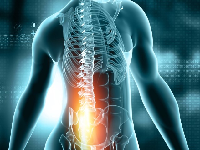 Lifestyle Changes to Prevent Back Pain