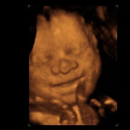 las-vegas-3d-4d-ultrasound