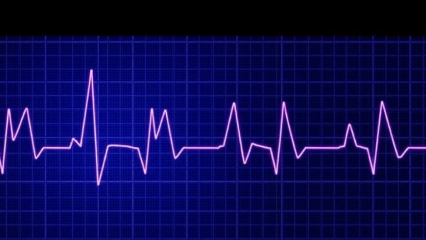 An AI reads an ECG in two seconds and finds what cardiologists cannot