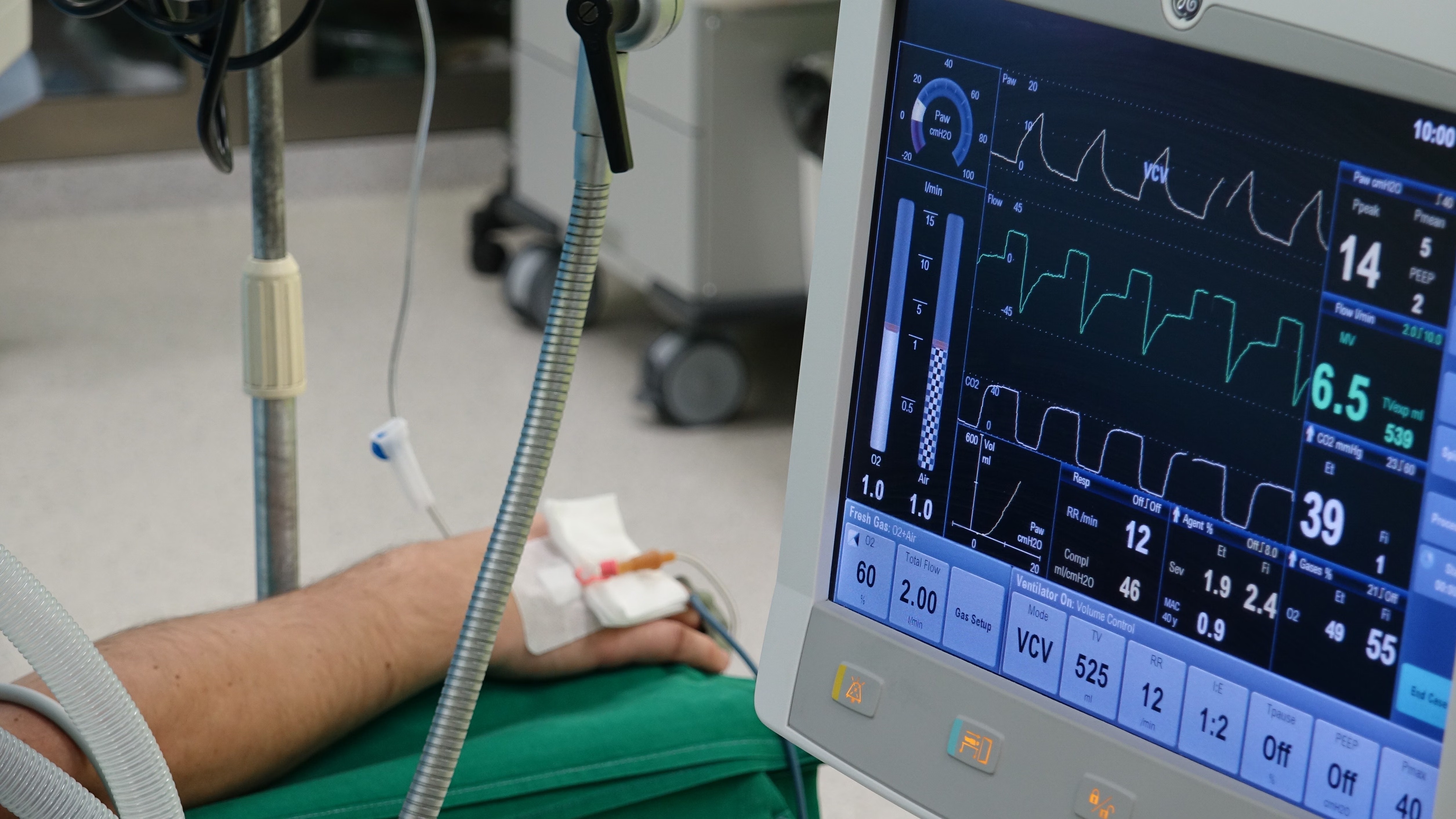 Hospital bedside patient monitor displaying vital signs during patient safety monitoring.