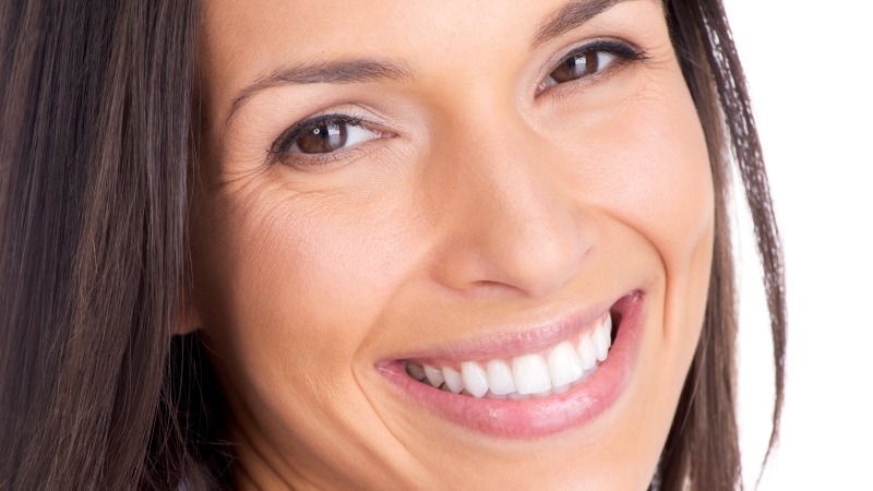 Beautiful Smile After Dental Implants