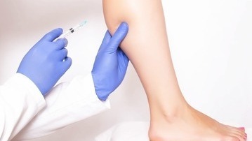 Eliminate Spider and Varicose Vains 