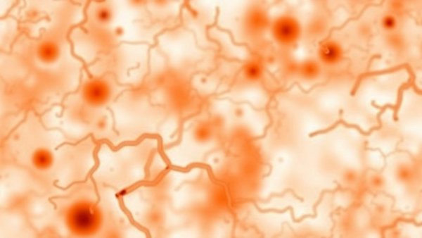 Salmonella Infection -- Diagnosis and Treatment