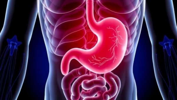 What Causes Gastritis and How to Support Your Stomach Lining