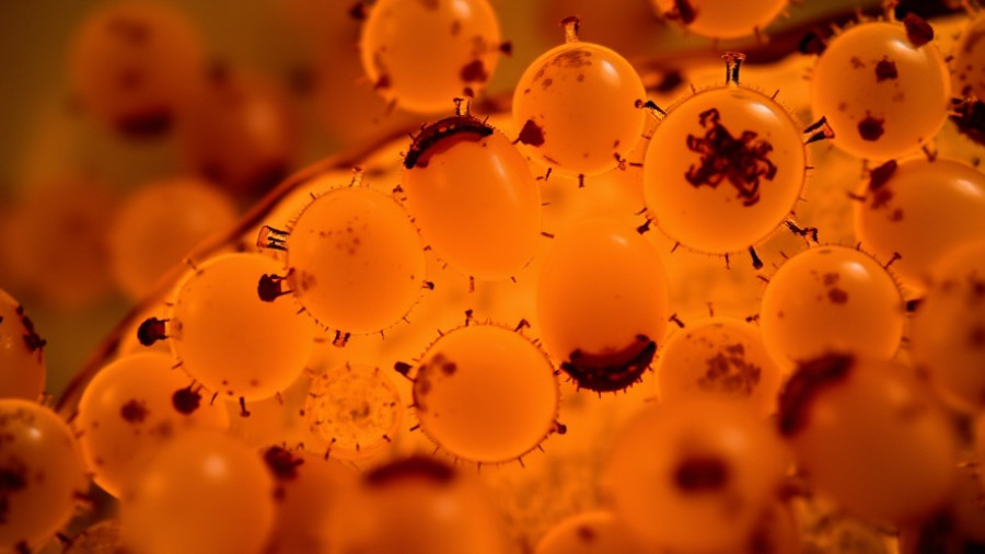 Microscopic view of ancient parasites in human feces showing oval-shaped eggs.