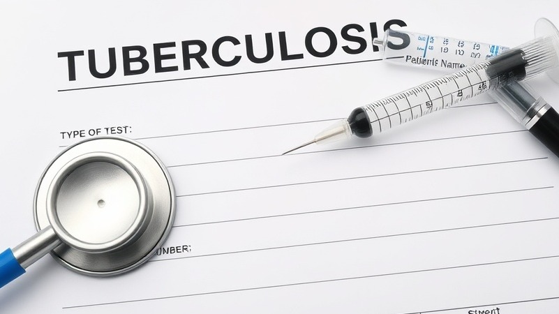The Hidden Mortality Insights in Tuberculosis Screening Tests Every Health Practitioner Should Know
