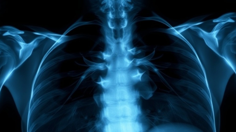 Navigating Esophageal Cancer Treatment Options for Comprehensive Patient Care