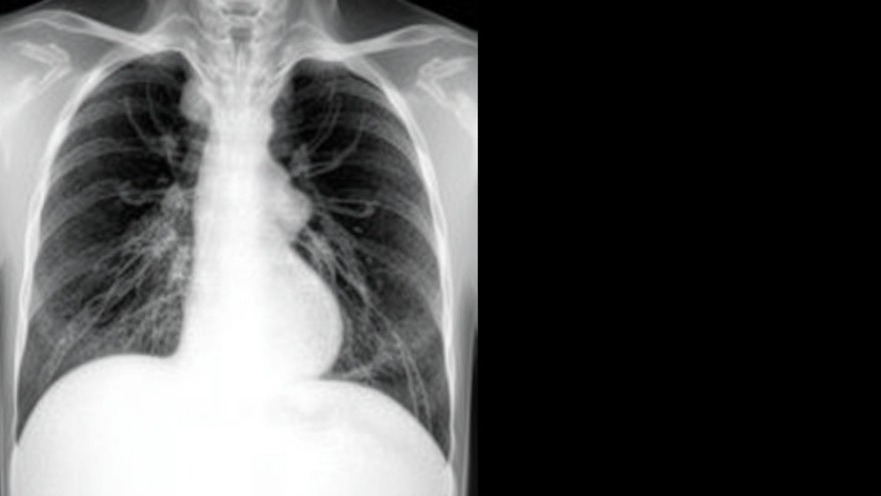 Exploring Biological Sex's Role in Lung Adenocarcinoma Treatments