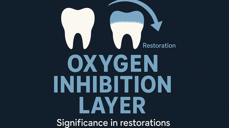 Dental infographic on oxygen inhibition layer significance.
