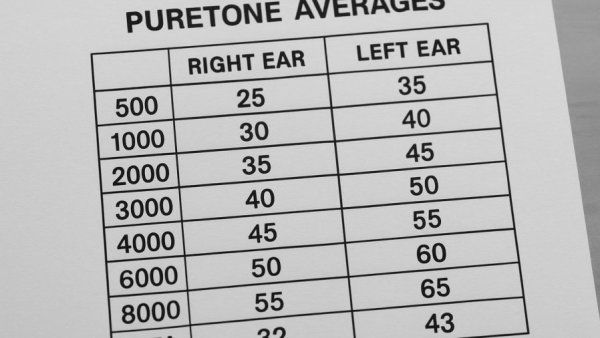 Statistical table of puretone averages for hearing aid fitting.