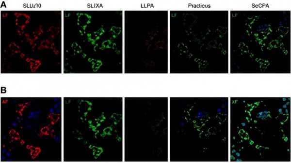 CIP2A mediates mitotic recruitment of SLX4/MUS81/XPF to resolve replication stress-induced DNA lesions