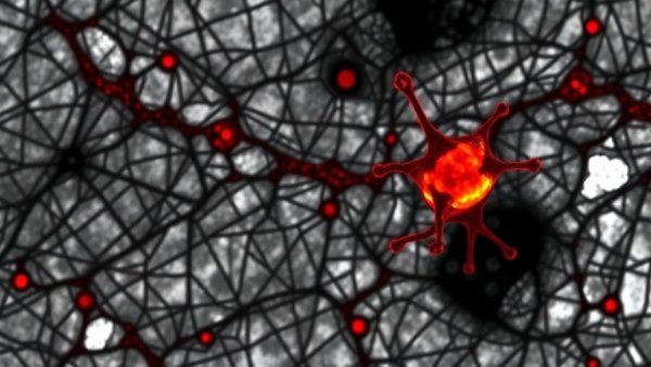 The chromatin guardian ATRX is a strong prognostic biomarker in melanoma
