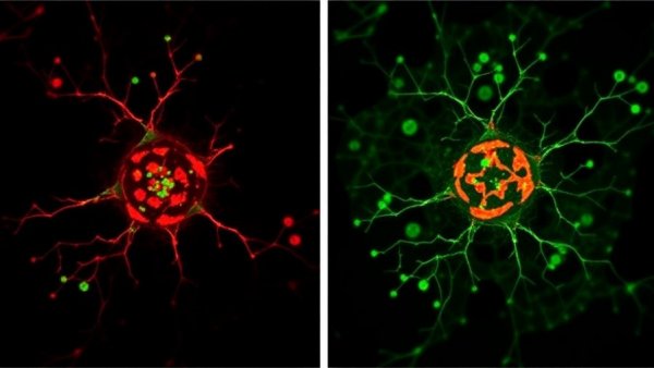 Fibroblast-mediated KRAS activation in double-negative prostate cancer